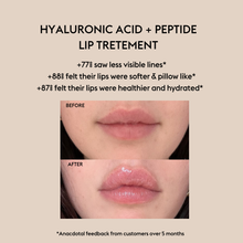 Load image into Gallery viewer, WATERMELON- Hyaluronic Acid + Peptide Lip Treatment
